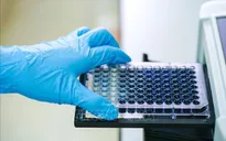 Mỹ đạt bước tiến mới trong phát hiện kháng thể chống virus SARS-CoV-2