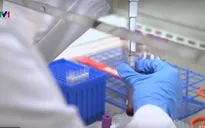 Thử nước bọt để phát hiện virus SARS-CoV-2