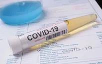 Mỹ thu hồi 12.000 bộ xét nghiệm SARS-CoV-2 do nhiễm khuẩn