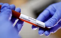 Các nhà khoa học Argentina chụp được ảnh virus SARS-CoV-2 lây nhiễm trong nước