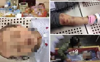 Khởi tố vụ án bé 3 tuổi bị bạo hành đến tử vong