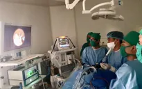 Phẫu thuật nội soi điều trị não úng thủy cho trẻ sơ sinh