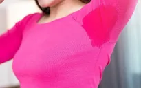 Làm thế nào ngăn mùi hôi dưới cánh tay trong ngày hè nắng nóng?