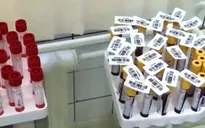 Nga bắt đầu sản xuất vaccine COVID-19 từ tháng 8