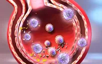180 người phơi nhiễm với virus SARS-CoV-2 sau khi dự lễ nhà thờ tại Mỹ