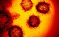Ánh nắng mặt trời có thể vô hiệu hóa virus SARS-CoV-2?