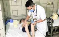 Nguy cơ bùng phát bệnh truyền nhiễm ở trẻ khi hè tới