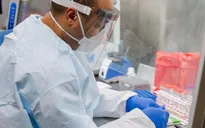 Italy thử nghiệm thành công kháng thể chống virus SARS-CoV-2