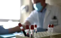 Italy thử nghiệm thành công kháng thể chống virus SARS-CoV-2