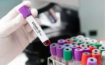 Trung Quốc có ca tái dương tính sau 2 tháng