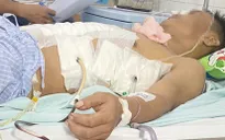 Khẩn nguy cứu người đàn ông bị đâm thấu ngực bụng
