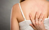 7 thói quen vô tình kích thích mụn lưng “đâm chồi”