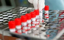 Nhật Bản cho phép xét nghiệm virus SARS-CoV-2 qua nước bọt