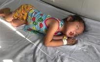 Cảnh báo viêm não ở trẻ