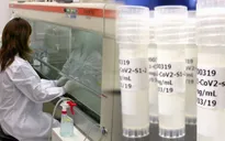 Nhật Bản sẽ thử nghiệm sử dụng tế bào gốc để chữa trị cho bệnh nhân COVID-19