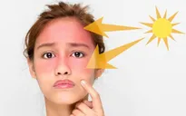 Những tác hại không ngờ đến làn da khi ở trong nhà quá lâu