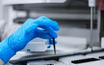 Thụy Điển mở rộng xét nghiệm tầm soát virus SARS-CoV-2