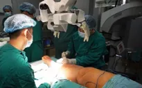Mổ nối bạch mạch - tĩnh mạch chữa phù do di chứng ung thư