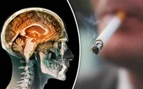 Hút thuốc lá làm tăng nguy cơ ung thư phổi di căn lên não