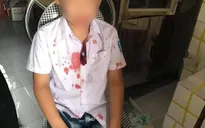 Giải quyết mâu thuẫn hộ con, phụ huynh hành hung bé trai ngoài cổng trường