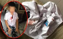 Bé trai lớp 1 bị bố của bạn hành hung vẫn hoảng loạn, sợ hãi