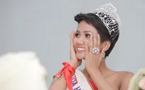 Sao Việt xúc động, chúc mừng ca phẫu thuật tách rời cặp song sinh thành công