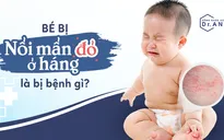 Bé bị nổi mẩn đỏ ở háng là bị bệnh gì?