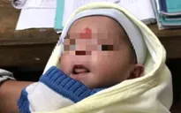 Bé gái sơ sinh bị bỏ rơi, kiến bám đầy người