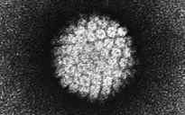 Virus HPV có thể gây ung thư tuyến tiền liệt