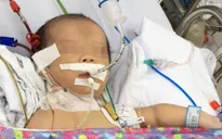 Lọc máu thành công cứu sống trẻ sơ sinh bị bệnh hiếm
