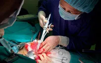 Sự nguy hiểm của ung thư gan thứ phát