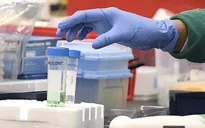 Triều Tiên lần đầu tiên thông báo ca nghi nhiễm virus SARS-CoV-2