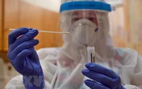 Biến thể mới của virus SARS-COV-2 đang lây lan mạnh hơn