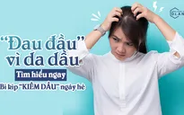 Cô nàng da dầu chớ bỏ qua bí kíp kiềm dầu ngày hè này