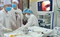 Tức ngực, khó thở cả tuần vì mảnh xương cá mắc trong lòng phế quản