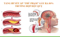 Xu hướng mới trong điều trị tăng huyết áp và phòng ngừa đột quỵ