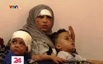 Nỗi ám ảnh của người tị nạn Syria từ vụ nổ tại Lebanon
