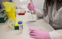 Cơ quan phát triển vaccine Sputnik V (Nga) đề nghị EMA xin lỗi