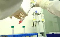 24 ca nghi nhiễm COVID-19 mới ở TP. Hồ Chí Minh có những người chỉ là F2 trong khi F1 âm tính
