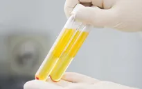 Điều trị bằng huyết tương cung cấp ngay kháng thể cho bệnh nhân COVID-19 để diệt virus
