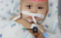Cứu bé trai 1 tuổi mắc viêm màng não mủ nguy kịch
