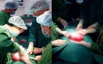 Rối loạn kinh nguyệt, rong kinh kéo dài vì u xơ nặng 3kg