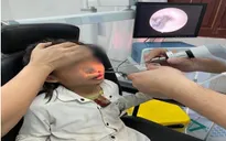 Gắp con tặc còn sống trong mũi hai bệnh nhi