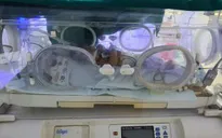 Sinh tại nhà, bé sơ sinh nguy kịch do mắc uốn ván