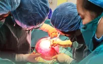 Cắt khối u gần 7kg cho người phụ nữ ở Hà Nội