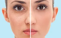 5 tác dụng làm đẹp da tuyệt vời từ việc tắm nước lạnh