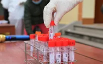 Thêm 36 ca mắc COVID-19 mới, Bình Dương có ca đầu tiên