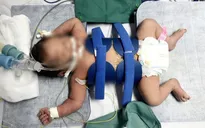 Cứu sống trẻ sơ sinh nguy kịch nhờ kỹ thuật hạ thân nhiệt