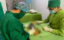 Đi làm cỏ lúa, người đàn ông bị máy cắt cỏ cắt đứt lìa bàn chân