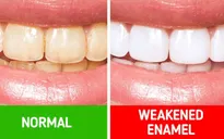 10 bí quyết chăm sóc răng miệng giúp bạn không bao giờ phải gặp nha sĩ
